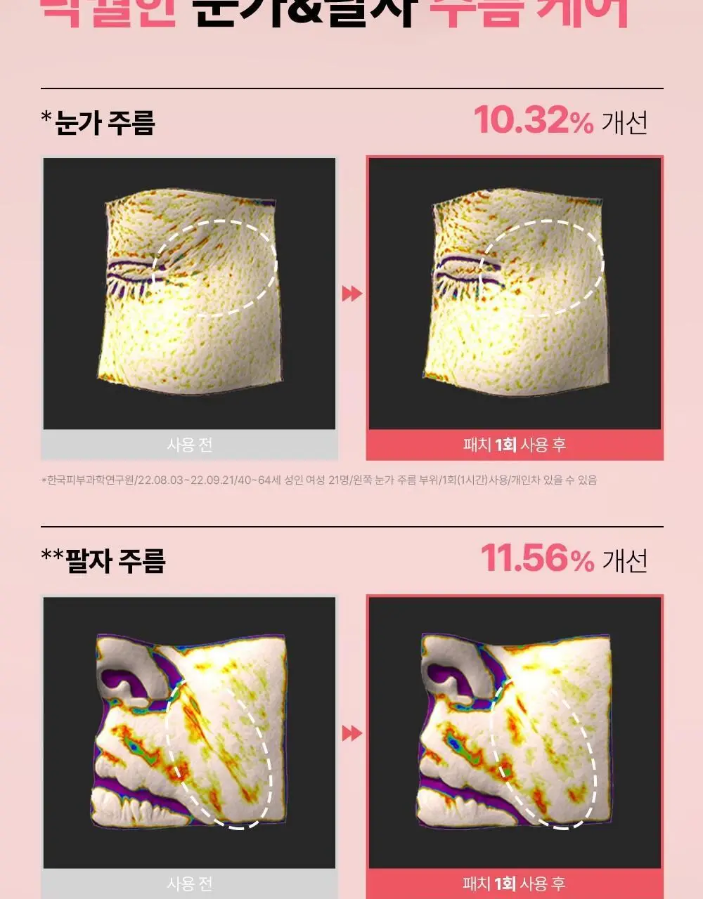 [집중주름패치] 더마펌 에이지 리바이빙 주름순삭패치 2종 택 1 (팔자6매+미간3매/팔자2매+미간1매) 상세페이지 19